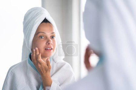 Photo for Woman Squeezing Pimple On Her Face. Acne Skin Problem - Royalty Free Image