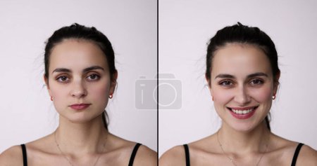 Before After Young Woman Aesthetic Facelift. Rhinoplasty Nose And Mid Face Surgery