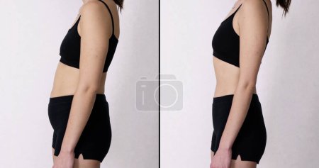 Foto de Woman Before And After Weight Loss On Gray Background - Imagen libre de derechos