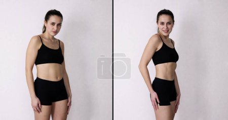 Téléchargez les photos : After After Weight Loss And Fat Liposuction - en image libre de droit