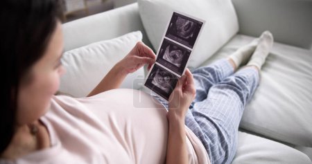 Foto de Pregnant Woman With Ultrasound Image Of Baby - Imagen libre de derechos