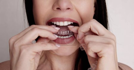 Téléchargez les photos : Clear Dental Aligner And Orthodontic Night Guard - en image libre de droit