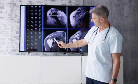 Téléchargez les photos : Physician Doctors Looking At Shoulder MRT Scan - en image libre de droit