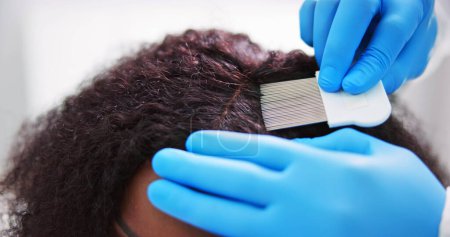 Photo for Scalp Treatment From Psoriasis And Dandruff. Dermatologist Doctor - Royalty Free Image