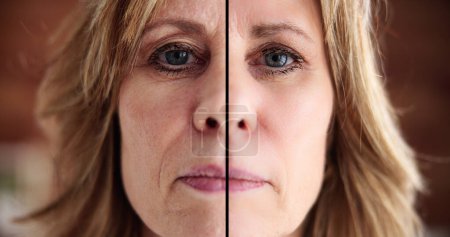 Téléchargez les photos : Woman Before After Skin Lift Dermatology Injection - en image libre de droit