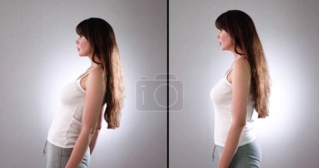Foto de Mujer con lordosis y curvatura normal contra fondo gris - Imagen libre de derechos