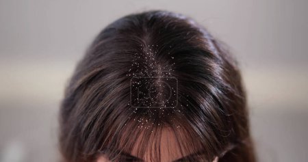 Photo for Itchy Head Scalp And Hair Dandruff Problem - Royalty Free Image