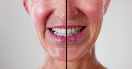 Foto de Dientes femeninos entre antes y después del tratamiento dental - Imagen libre de derechos