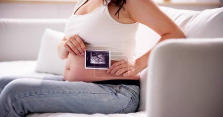 Téléchargez les photos : Gros plan d'une femme enceinte avec une photo échographique de son bébé - en image libre de droit