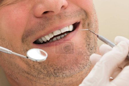 Foto de Feliz maduro hombre tener dental chequeo en clínica - Imagen libre de derechos