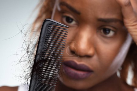 Téléchargez les photos : Gros plan d'une femme africaine choquée souffrant d'un problème de perte de cheveux - en image libre de droit