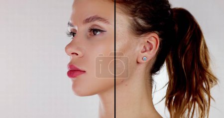 Foto de Inyección de terapia de elevación facial antes y después de la mujer - Imagen libre de derechos