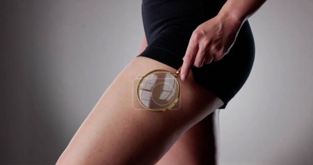 Photo for Close-up Of A Woman Checking Cellulite With Magnifying Glass - Royalty Free Image