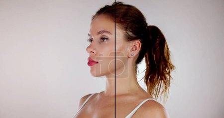Téléchargez les photos : Femme avant et après l'injection de thérapie de lifting du visage - en image libre de droit