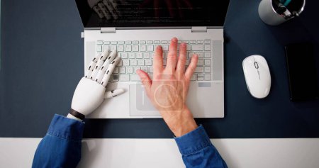 Téléchargez les photos : Homme avec la main prothétique travaillant sur ordinateur portable. Membre artificiel - en image libre de droit