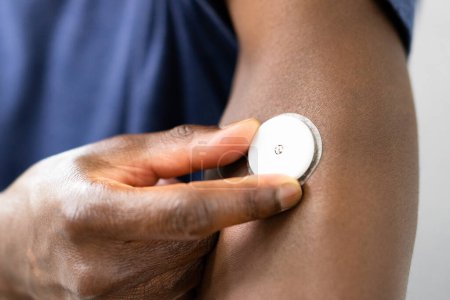 Téléchargez les photos : Essai continu de glucomètre sur l'homme noir diabétique - en image libre de droit