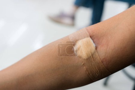 Téléchargez les photos : Plâtre et coton sur le bras de la femme après analyse de sang ou don de sang - en image libre de droit