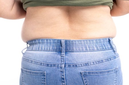 Foto de Vista trasera. mujeres gordas tiene sobrepeso - Imagen libre de derechos