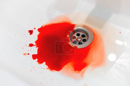 Sangre en un fregadero de cerámica blanca. Encías sangrantes o heridas de una persona. Primer plano de una abundancia de sangre en el baño.