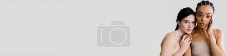 Téléchargez les photos : Africaine jeune femme debout avec femme caucasienne avec vitiligo sur fond de mur blanc, deux modèles féminins divers posant ensemble - en image libre de droit