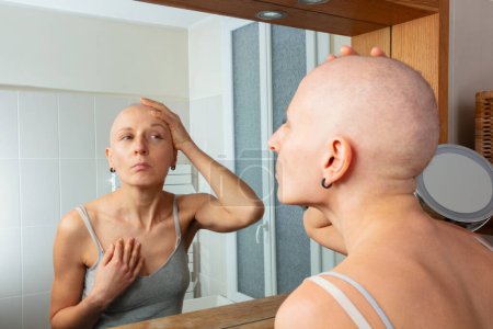 Foto de Una mujer sin pelo después de la terapia del cáncer usando una camisa sin mangas se estudia en un espejo, una mano tocándose la cabeza de una manera pensativa - Imagen libre de derechos