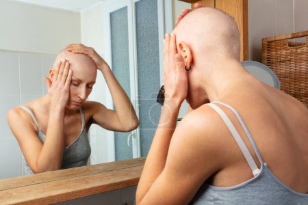 Foto de Una mujer reflexiva con calvicie causada por la quimioterapia observa cuidadosamente su semejanza en un espejo de baño, la mano colocada en la cabeza desnuda - Imagen libre de derechos
