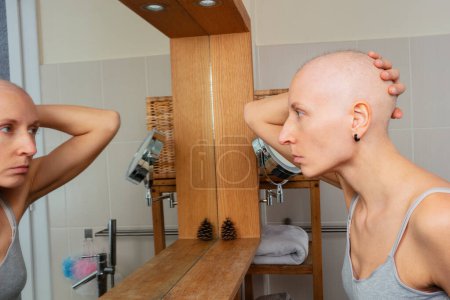 Foto de Una mujer calva luchando contra el cáncer reflejándose pensativamente en un espejo en un baño luminoso - Imagen libre de derechos