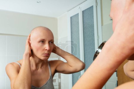 Foto de Una mujer calva examina su reflejo en el espejo del baño, tocando la cabeza con ambas manos - Imagen libre de derechos