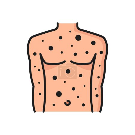 Illustration for Allergy rash or acne color line icon. Seasonal health problem, disease or allergic reaction outline vector symbol. Food or cloth material allergy symptom pictogram or icon with skin rash on man torso - Royalty Free Image