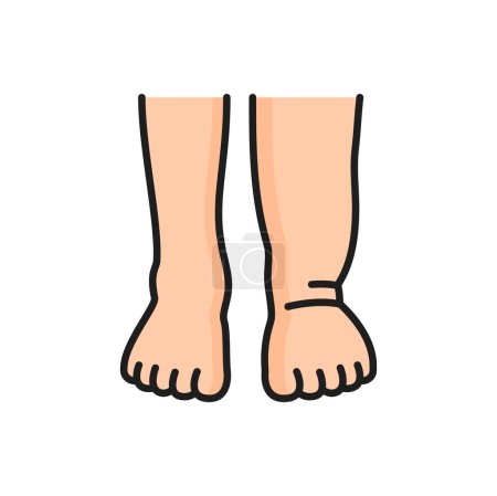 Fußerkrankungen und Verletzungen des Fußes, allergische Reaktion Farbreaktion Symbol. Vektor-Lymphödem, Schwellungen der Beine und Ödeme allergische Reaktion