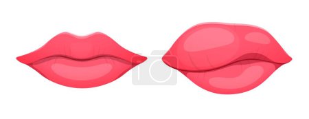 Illustration for Angioedema or edema of lips. Body tissue swelling, allergic syndrome, dermatology edema disease or infection inflammation symptom, healthcare or medical problem concept with woman cartoon vector lips - Royalty Free Image