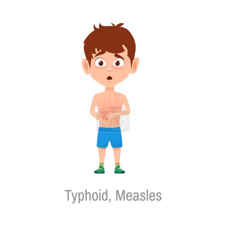 Illustration for Typhoid measles kid disease. Isolated vector sick boy with red rash on body. Dangerous sickness symptoms, cartoon character with infection. Kids health care and illness treatment - Royalty Free Image