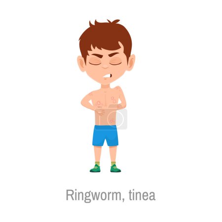 Illustration for Child with ringworm tinea disease symptoms. Isolated vector sick boy with rash caused by fungal infection of skin. Dermatophytosis illness with red, itchy, scaly, circular rash on body - Royalty Free Image