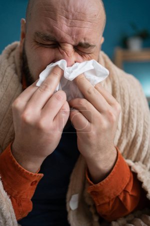 Téléchargez les photos : Gros plan d'un homme souffrant d'un écoulement nasal assis à la maison en train de s'essuyer le nez avec une serviette en papier. Concept de rhume et grippe - en image libre de droit