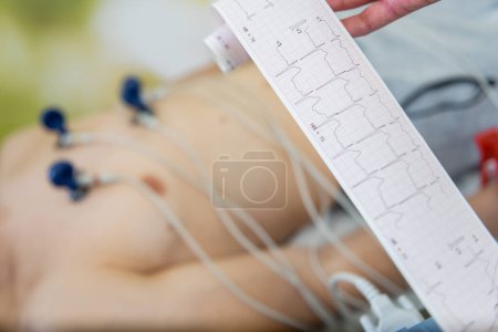 Paciente sometido a una prueba de electrocardiograma con electrodos conectados al tórax, mientras un profesional sanitario examina la lectura del ECG.