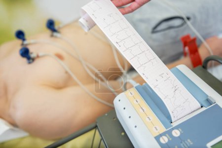 A patient undergoing an electrocardiogram test with electrodes attached to the chest, as a healthcare professional examines the ECG readout.