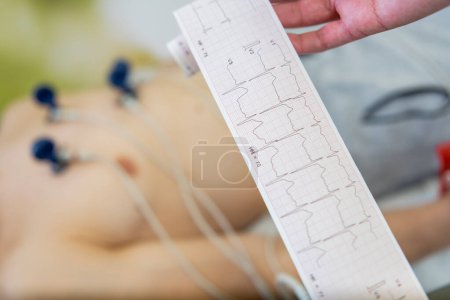 Ein Patient unterzieht sich einem Elektrokardiogramm-Test mit Elektroden, die an der Brust befestigt sind, während ein medizinisches Fachpersonal die EKG-Ablesung untersucht.