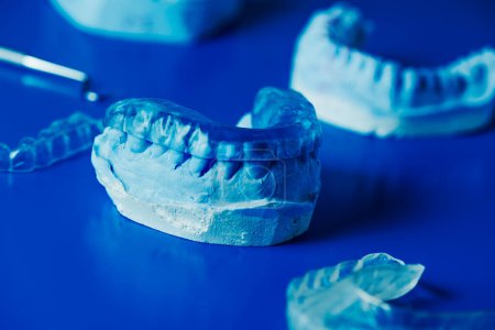 Foto de Primer plano de una férula oclusal en un molde dental sobre una superficie azul junto a otros moldes dentales y férulas oclusales - Imagen libre de derechos