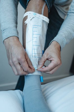 Nahaufnahme eines Mannes in Freizeitkleidung, der mit elastischen Riemen einen Urin-Abflussbeutel an seinem Bein befestigt