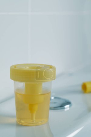 Photo for Closeup of a sterile container with a sample of urine on the cistern of a toilet in a white bathroom - Royalty Free Image