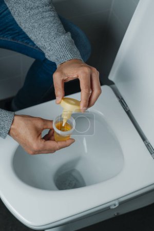 Photo for Closeup of a man in the bathroom collecting a urine sample in a sterile container - Royalty Free Image