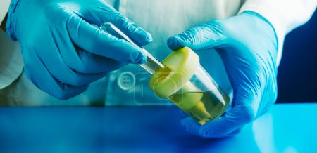 Photo for A man, wearing a white coat and blue rubber gloves, filling a tube with a urine sample from a sterile container, in a panoramic format to use as web banner - Royalty Free Image