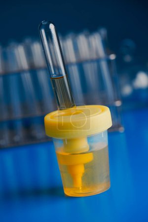 Photo for Closeup of a sterile container with a sample of urine placed on a blue table in the laboratory - Royalty Free Image