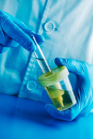Großaufnahme eines Laborarbeiters, der einen weißen Mantel und blaue Gummihandschuhe trägt und einen Schlauch mit einer Urinprobe aus einem sterilen Behälter füllt