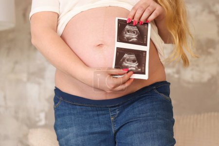 Téléchargez les photos : Le ventre d'une femme enceinte. Une femme enceinte méconnaissable tient une photo échographique avec son bébé en gros plan. Concentration sélective. Concept de grossesse et de maternité. - en image libre de droit