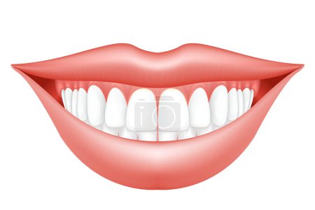 Illustration for Smile makeover, woman lips and dentition, semiopen mouth with hollywood smile, dental clinic, vector - Royalty Free Image