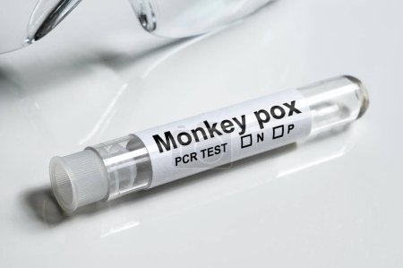 Monkeypox test tube on white medical desk close-up. Equipment for monkey pox virus diagnostics and smallpox research. Concept of monkeypox, PCR testing, result, science, laboratory, health and cure.