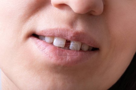 Téléchargez les photos : Gros plan de la bouche souriante ouverte de la femme avec trou teeht. Lèvres et dents inhabituelles. - en image libre de droit