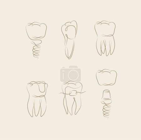 Ilustración de Implante de colección de dientes, tirantes, corona de dientes, dibujo de sello dental en estilo lineal sobre fondo beige - Imagen libre de derechos
