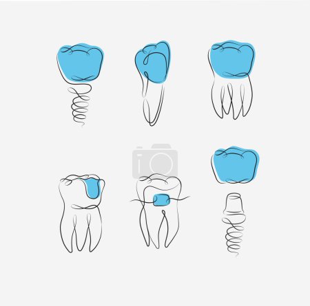 Ilustración de Implante de colección de dientes, tirantes, corona de dientes, dibujo de sello dental en estilo lineal sobre fondo blanco y azul - Imagen libre de derechos